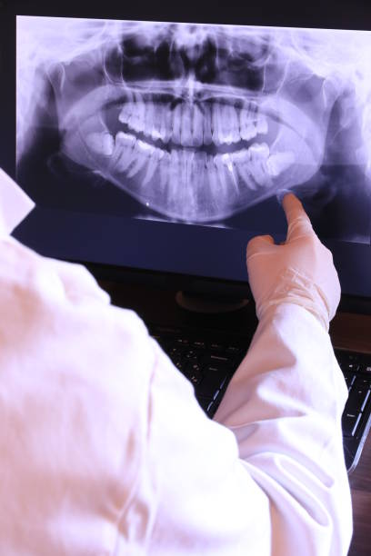 Best Dental Abscess Treatment in Newport, RI