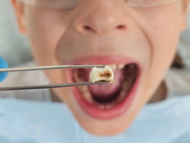 Best Emergency Denture Repair in Newport, RI